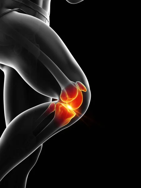 Painful Knee Computer Illustration — Stock Photo, Image