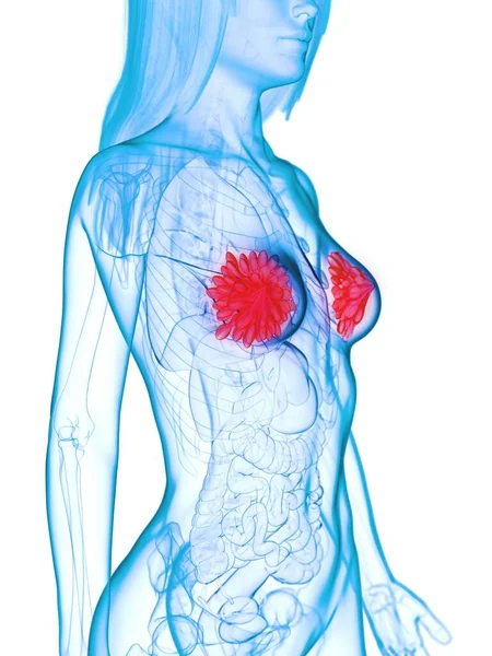 Болезненные Молочные Железы Компьютерная Иллюстрация — стоковое фото