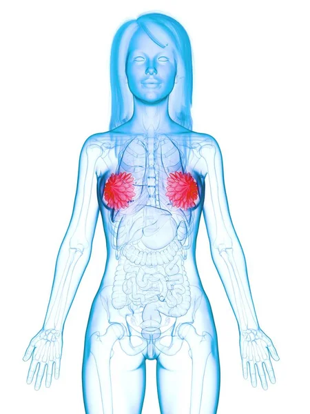 病気の乳腺 コンピュータイラスト — ストック写真
