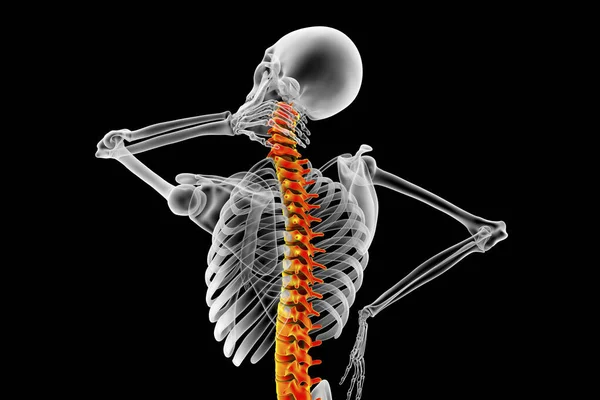 Human Neck Pain Computer Illustration — Stock Photo, Image