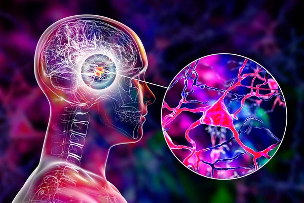 Ілюстрація Мигдалини Мозку Крупним Планом Вид Нейронів Мигдалина Частиною Лімбічної — стокове фото