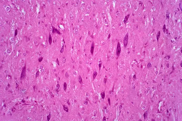 Motorische Neuronen Leichte Mikrographie Motoneuronen Des Rückenmarks Sind Teil Des — Stockfoto