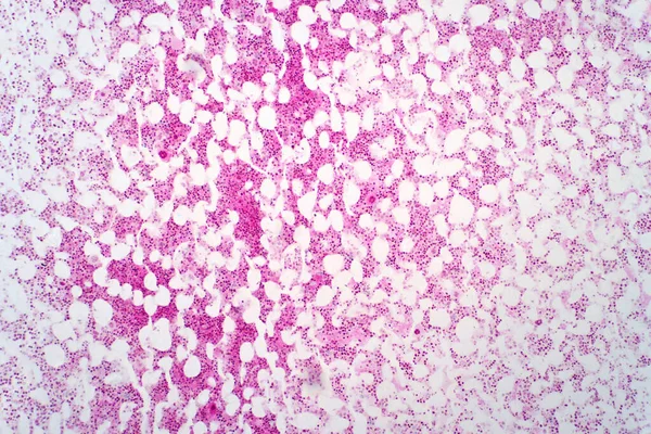 ヒトの骨髄 軽いマイクログラフ ヘマトキシリン及びエオシン染色 — ストック写真