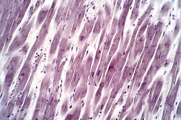 人的心脏组织 光显微镜 Haematoxylin Eosin Stain — 图库照片