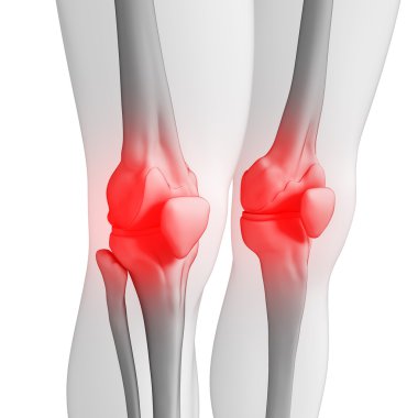 Human knee pain artwork clipart