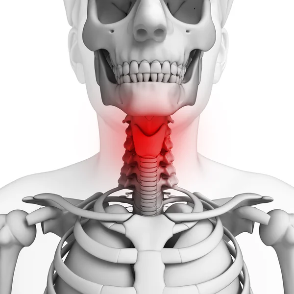 Människans hals smärta konstverk — Stockfoto