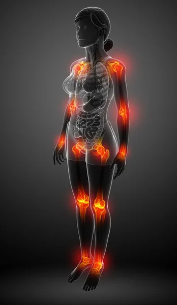 Female body all joint pain — Stock Photo, Image