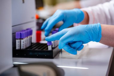 Teknisyen kan tüplerini laboratuvar santrifüjüne yerleştiriyor. Mavi lateks eldivenli ellere odaklan. Yakın çekim..