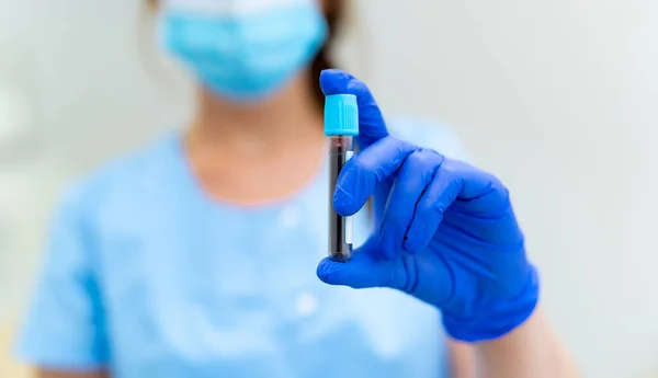 Prøverør Med Blodprøve Hånden Sygeplejerske Bedrift Reagensglas Med Positive Coronavirus - Stock-foto