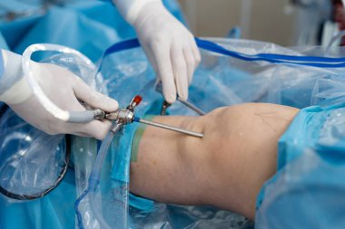 Özel ekipman taşıyan ve dizinden ameliyat sağlayan koruyucu eldivenler giyen bir cerrah. Tıp konsepti