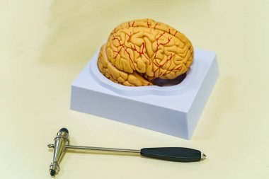 Masada beyin modeli var. Nöroşirürji konsepti. Nöroşirürji Hummer. Beyin insan anatomisi. Tıp konsepti