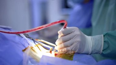 Eldivenli bir doktorun elleri, kan dolu bir tüple bir alet tutuyor. Kapatın. Nöroşirürji konsepti.