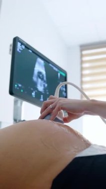 Kyiv, Ukrayna, 2 Mayıs 2025: Yeni doğan bebeğin doğum öncesi analizi. Hamile ultrason taraması. Dikey video