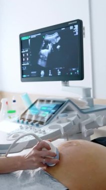 Kyiv, Ukrayna, 2 Mayıs 2025: Sonogram hamilelik testi. Modern hastane göbek taraması. Dikey video