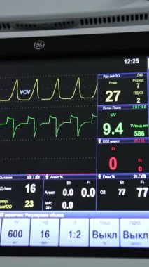 Akciğer havalandırma makinesinin siyah ekranındaki parametrelerin ve figürlerin çeşitliliği. Kapatın. Ameliyathane ekipmanı. Dikey video
