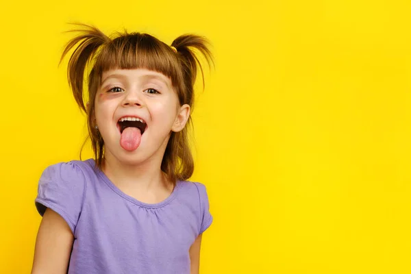 Крупный план смешной маленькой девочки с ушибленным глазом, показывающей свой язык — стоковое фото