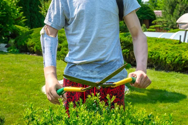 L'uomo con un braccio amputato e una protesi sta potando cespugli in un giardino — Foto Stock