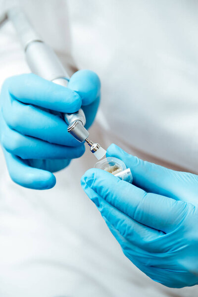 Professional teeth cleaning. The dentist in blue gloves holds the brush and paste.
