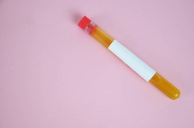 Pembe arka planda test tüplerinde sarı renkli sıvılar var.