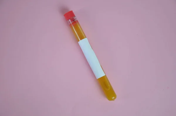 Líquidos coloridos amarelos em tubos de ensaio sobre fundo rosa — Fotografia de Stock