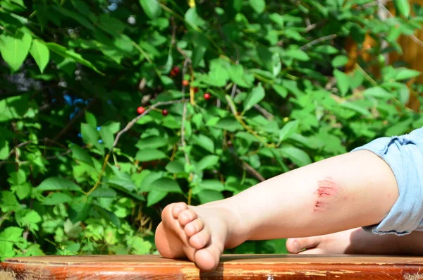 Fechar o joelho de crianças feridas depois que ele caiu no pavimento. A perna dos rapazes dói. hematomas, arranhões após passeios de verão ou esportes. pomada anestésica Fotos De Bancos De Imagens