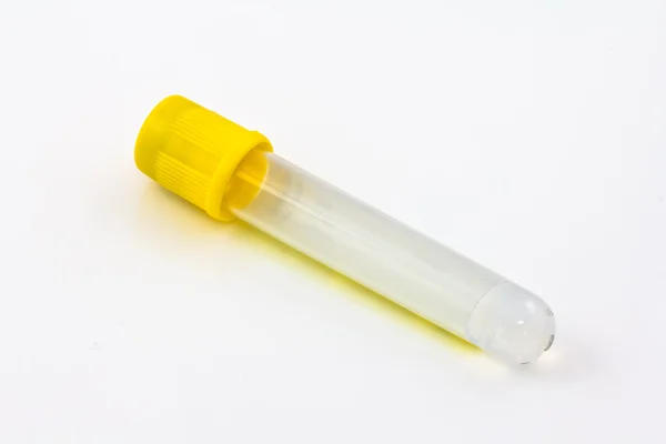 Test tube with yellow plug — Stock Photo, Image