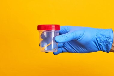 Tıbbi muayene konsepti. Perosn, parlak sarı arka planda idrar testi bardağını tutuyor.