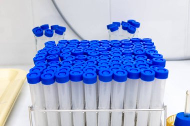 Metal bir rafta mavi vida kapaklı plastik laboratuvar örnek tüpleri temiz bir laboratuvar tezgahına yerleştirilmiş..