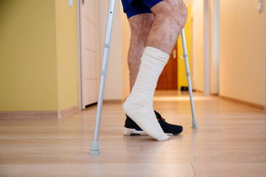 Alçılı atletlerin bacakları. Bacağı bandajlı, alçılı.