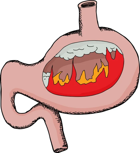 Bauch mit Flammen im Inneren — Stockvektor