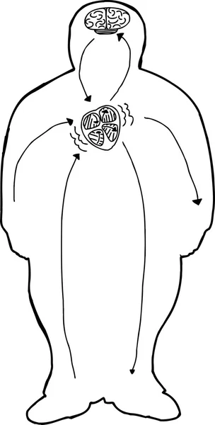 Gráfico sobre acidente vascular cerebral —  Vetores de Stock