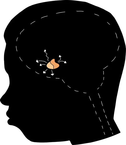 Silhouette with Pituitary Gland — Stock Vector