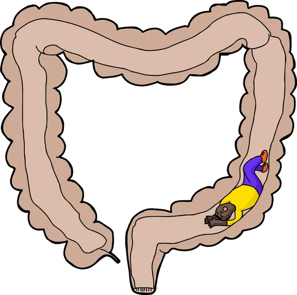 kişi bağırsak içinde sıkışmış