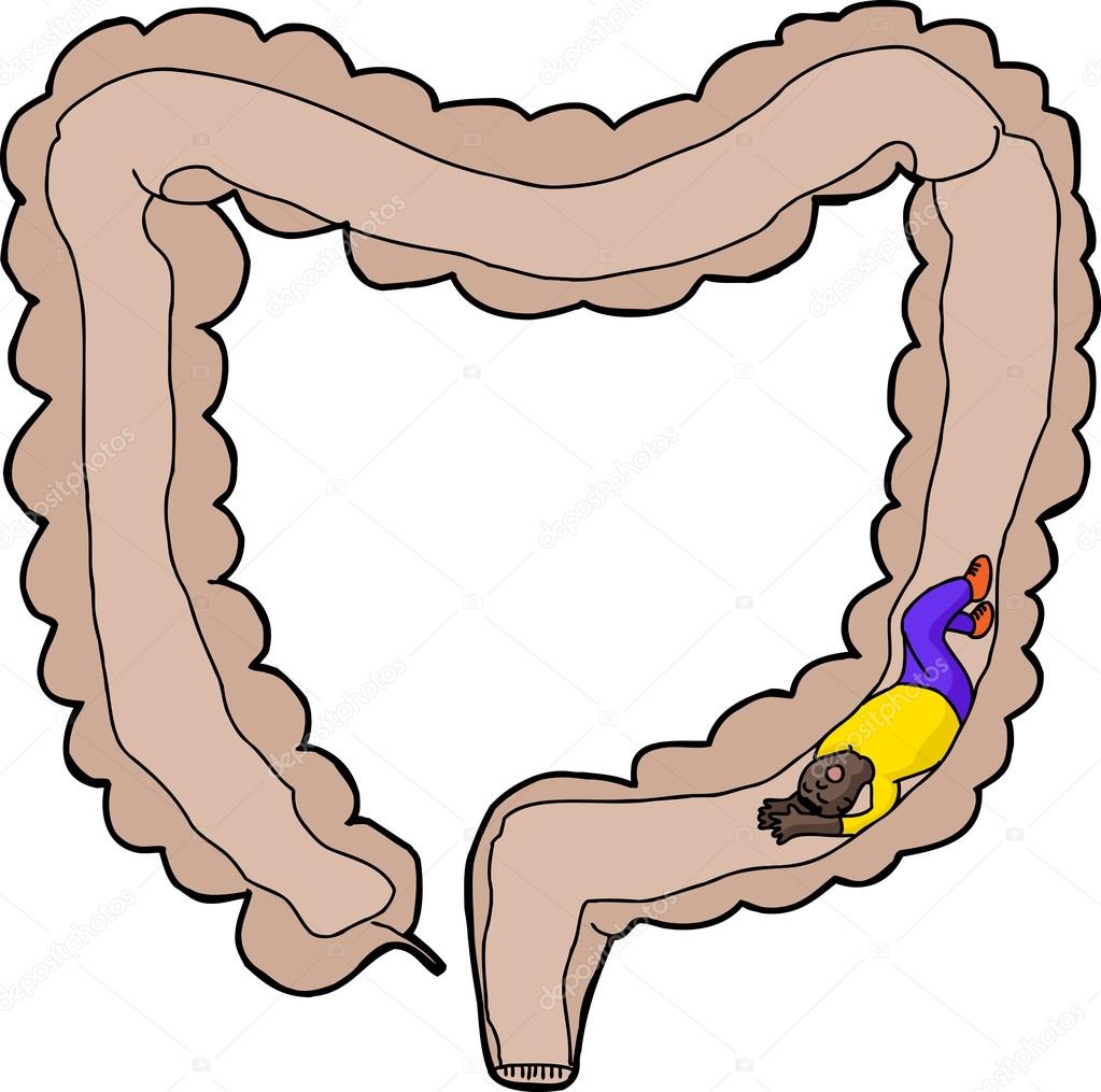 Person Stuck Inside Intestine