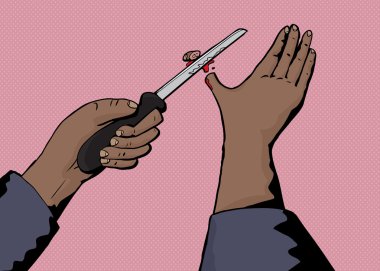 Yanlışlıkla başparmak kesilmesinin