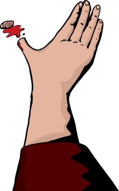 Parmağını doğranmış