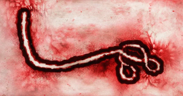 Mikroskooppinen näkemys ebola-viruksesta — kuvapankkivalokuva