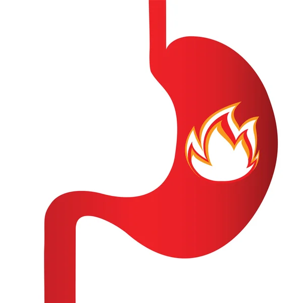 Burning sensation in the stomach — Stock Vector