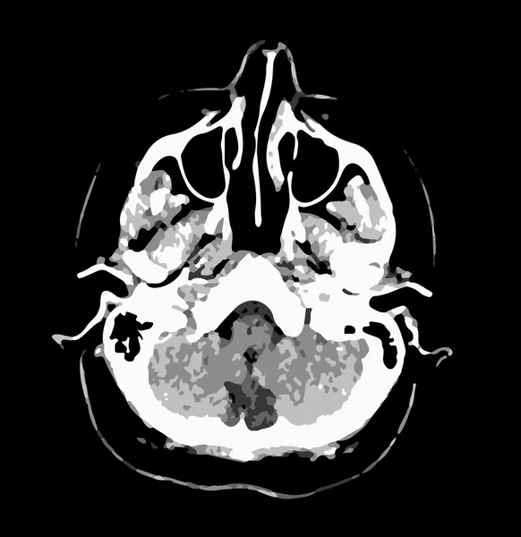 脳、黒と白のベクトル グラフィックの ct スキャン — ストックベクタ