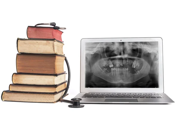 Bücher und Röntgen im Laptop — Stockfoto
