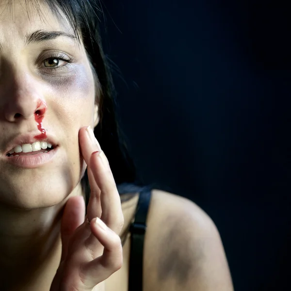 Mujer con sangre y moretones sintiendo dolor después de la violencia — Foto de Stock