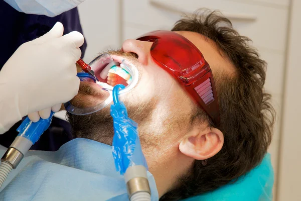 Närbild av mannen att få tänder whitened av tandläkare — Stockfoto