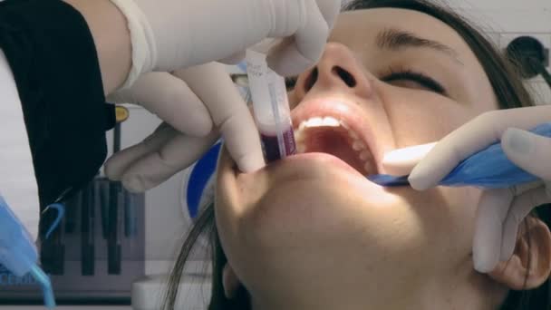 Salud dientes problema mujer en el dentista — Vídeos de Stock