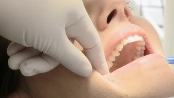 Vrouw tanden gerepareerd bij tandarts dolly extreme close-up shot — Stockvideo