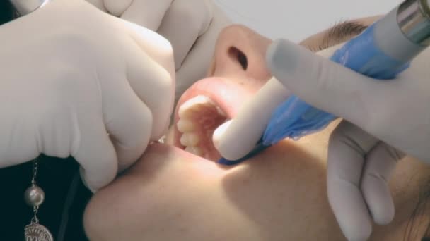 Mulher obtendo dentes reparados no dentista — Vídeo de Stock