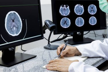 Not alırken bilgisayardaki tomografi görüntülerini inceleyen bir doktor.. 