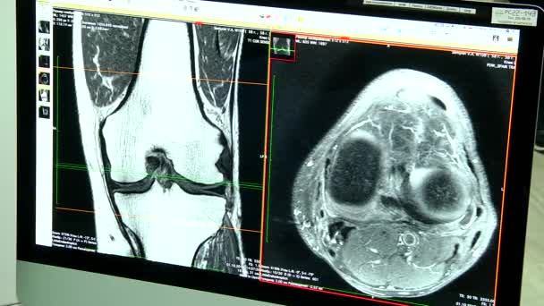 CT scan du patient en dynamique — Video