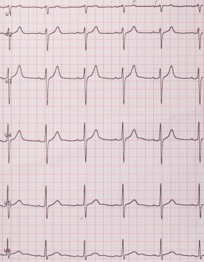kalp atım kardiyogram 