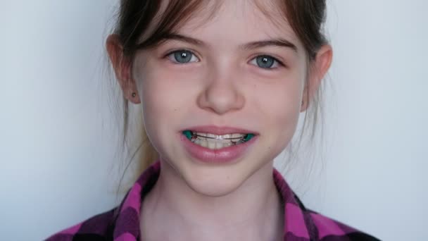 Klein, jong lachend meisje draagt een orthodontisch tandheelkundig apparaat, beugel, beugel. — Stockvideo