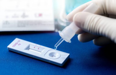 El ele tutuşma tüpü ve kovid 19 antijen öz testinin test cihazına damlatılıyor. Koronavirüs enfeksiyonunu tespit etmek için antijen test kiti. Hızlı antijen testi. Coronavirus teşhisi. Tıbbi aygıt.